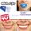 Συσκευή Λεύκανσης Δοντιών WHITE LIGHT (Υγεία & Ευεξία)